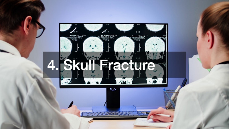 skull MRI